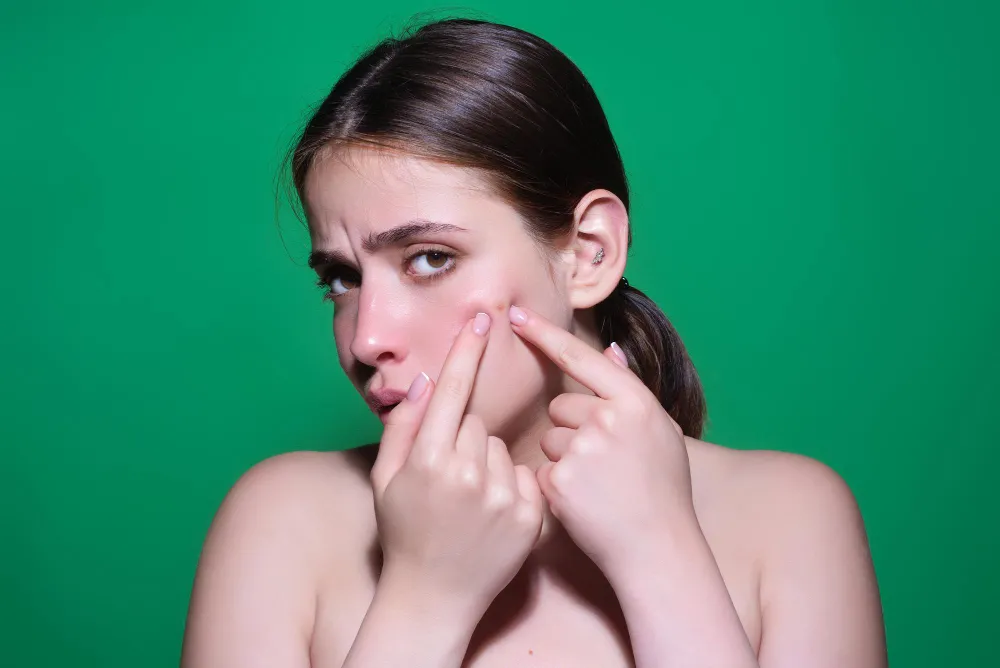 Cause Acne Breakouts